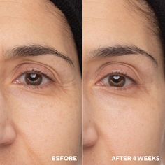 FEATURES: For anyone looking to achieve firmer, brighter, more youthful under-eyes. Formulated with 0.65% Universal Tri-Retinol Complex and our exclusive, patented peptide CellRenew-16, this restorative eye balm delivers visible anti-aging benefits to the delicate eye area without causing inflammation. Proven to deeply Retinol Benefits, Skin Center, Undereye Circles, Chemical Peel, Anti Aging Treatments, Eye Contour