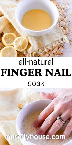 Gel Nail Art Ideas, Natural House Cleaners, Cute Nails Black, Nail Remedies, Nail Growth Tips, Hand Soak, Strengthen Nails, Nail Care Diy, Grow Nails Faster