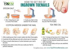 The latest in organic living with tips and info on food, gardening, natural remedies, and keeping your home free of harmful toxins. Coffee Facial, Toenail Fungus Remedies, Top 10 Home Remedies, Ingrown Toenail, Homemade Lotion, Home Remedies For Hair, Ingrown Toe Nail, Toenail Fungus, Natural Therapy