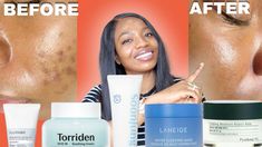 "Struggling with acne? This YouTube video breaks down everything you need to know about barrier creams and how they can help clear your skin fast! Learn how barrier creams protect and repair your skin's natural barrier, lock in moisture, and reduce irritation, paving the way to healthier, clearer skin. Watch now to discover the right way to use barrier creams in your skincare routine! #SkincareTips #ClearSkin #BarrierCream #AcneHacks" Acne Hacks, Clear Your Skin, Get Clear Skin, Barrier Cream, Clearer Skin, Skin Barrier, Sleep Mask, Korean Skincare