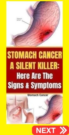 STOMACH CANCER A SILENT KILLER: Here Are The Signs & Symptoms Stomach Cancer Summer Dresses For Wedding Guest