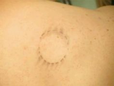 the back of a woman's breast with small circles on her left and right side