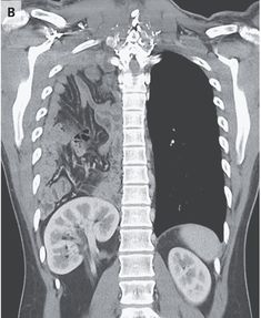 an x - ray shows the back end of a person's head and neck