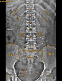 an x - ray shows the different bones and their corresponding regions, including the ribs