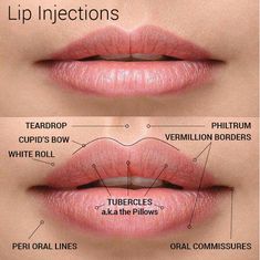 Derma Fillers, Lip Types, Facial Fillers, Cosmetic Injectables