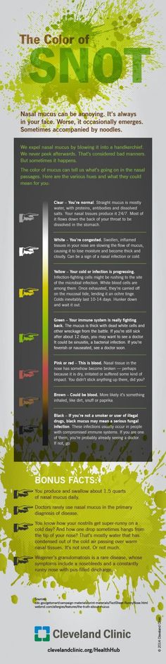 The color of snot (Infographic) | ScienceDump (SO NECESSARY, Y'ALL!) Mucus Color, Independent Day, Respiratory Therapy, Nursing Tips, Cleveland Clinic, Sinus Infection, Medical Information, Anatomy And Physiology, Health Info