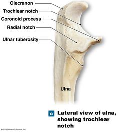 the structure of a long bone with labels on each side and labeled in text below