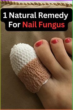 Natural ingredients may support long-term nail wellness. #nailhealth #wellnesssolutions Ugly Toenails, Toenail Health, Toenail Fungal Infection, Nail Remedies, Natural Antifungal, Nail Fungus Remedy, Nail Infection, Fungal Nail, Ingrown Toe Nail