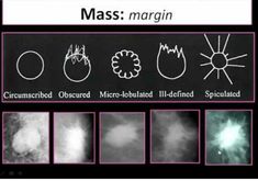 the image shows different types of clouds and their names