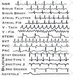 EKG Strips SVG Cardiac Monitor Nurse, Technician, Doctor Gift Digital Download - Etsy Switzerland Cardiac Nurse Aesthetic, Cardiac Technician, Nurse Technician, Gifts For Nursing Students, Cardiac Nurse