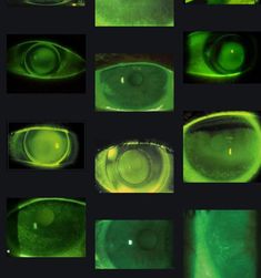 several images of the inside of an eye with green light coming from one side and another part of the viewer's lens