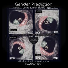 three different images of an animal's eye with the words gender projection on them