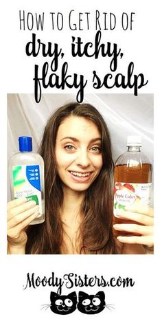 Dry Flaky Scalp Remedy Black Hair, Hair Mask For Itchy Scalp, Itchy Dry Scalp Remedy, Diy Scalp Detox, Itchy Head, Dry Scalp Remedy, Itchy Flaky Scalp, Lemon Hair, Hair Detox