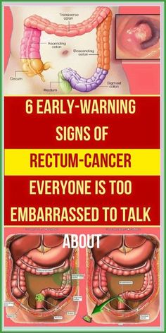 6 early warning symptoms of anal c by jennifer Harris | This newsletter was created with Smore, an online tool for creating beautiful newsletters for educators, businesses and more Sigmoid Colon, Health Planner, Back Pain Exercises, Japanese Women, Health Remedies, Back Pain, Fitness Tips, Health Tips