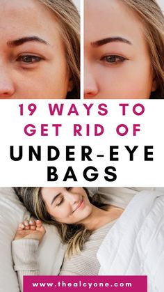 Under-eye bags making you look tired? Learb solutions, from DIY treatments to tips on lifestyle adjustments that can refresh your look.