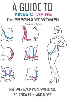 the guide to kinesio taping for pregnant women