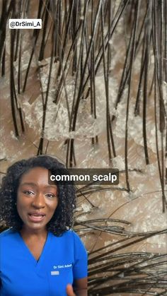 Stop Dandruff + Best Ingredients | Itchy Scalp Trichology Tips, How To Deep Clean Your Scalp, Dry Itchy Flaky Scalp Remedy, How To Stop Itchy Scalp, Scalp Psorasischic, Scalp Psorasischic Remedies, Dry Flaky Scalp Remedy, Flaky Scalp Remedy, Hair Care For Dandruff