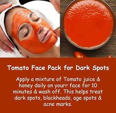 Tomato Face, Face Pack, Perfect Skin Care Routine, Homemade Beauty Tips