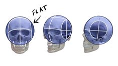 three different views of a human skull with the same facial structure as it appears to be showing