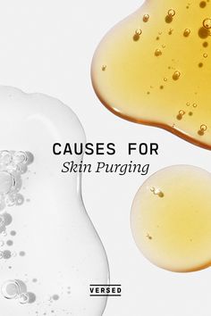 We asked experts to give us their take on all things related to skin purging and how to treat it. What Is Skin, Skincare Ads, Skin Advice, Email Marketing Design Inspiration, Shopify Design, Instagram Graphic, Health Planner