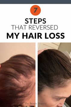 How to stop thinning hair after 50 can be daunting and frustrating. Here are 7 easy lifestyle and hair product changes to try immediately. Thinning Hair Remedies, Stop Hair Breakage, Scrub Corpo, Hair Thickening, Hair Product, Hair Remedies