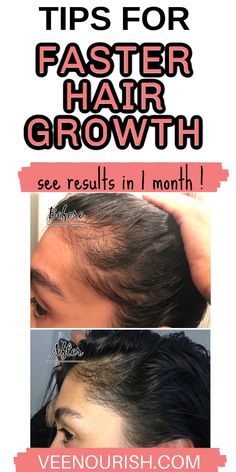 Want to grow hair super fast ? If so, follow these hair growth tips and hair growth hacks for super fast hair growth. Learn how to grow your hair faster overnight with a natural overnight hair loss treatment. These tips for growing out hair faster actually work, click to read more! Hair Regrowth Remedies, Hair Regrowth Women, Postpartum Tips, Postpartum Hair, Get Thicker Hair, Overnight Hairstyles, Hair Growth Secrets, Hair Regrowth Treatments, Hair Growth Supplement