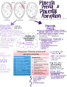 a whiteboard with purple writing on it that says placenta, practia and placement