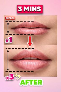 #plumplips #lipfiller #lips #lipinjections #beauty #lipenhancement #lipaugmentation #lipfillers #dermalfillers #fillers #juvederm #aesthetics #lipgoals #botox #perfectlips #hyaluronicacid #russianlips #juicylips #lipgloss #restylane #nurseinjector #skincare #injectables #antiaging #filler #biglips #cheekfiller #beautifullips #pout #poutylips How To Have Bigger Lips, How To Get Bigger Lips, Get Plump Lips, Naturally Plump Lips, Make Lips Bigger, Bigger Lips Naturally, Bb Lips, Bigger Lips, Fuller Lips Naturally