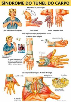 Chiari Malformation Awareness, Chiari Malformation, Med School Motivation, Med School, School Motivation