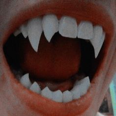 an open mouth with white teeth and orange gums