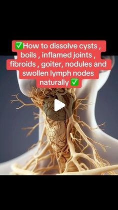 Essential Oils For Baker Cysts, How To Get Rid Of Cysts On Ovaries, Castor Oil For Cysts, Castor Oil For Thyroid, Medicinal Recipes, Castor Oil Uses, Human Body Science, Thyroid Healing, Herbal Health