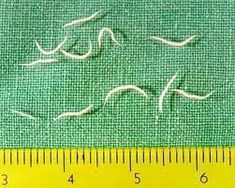 Basic information about pinworms, hookworms, threadworms and tapeworms.  How to avoid them.  Medicine for treatment. Intestinal Parasites, Parasite Cleanse, Earth Mama, Detox Program, Detox Cleanse, Medical Problems, Natural Home Remedies, Homeopathy, Natural Treatments