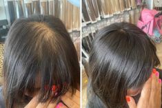 Hairstyles To Hide Thinning Crown, Hair Colour For Thinning Hair, Style Thinning Hair Women, Wedding Hair Thinning Hair, Hairdo For Thinning Hair, Balding Hairstyles Women, Loss Of Front Hair, How To Hide Thinning Hair For Women, Hairstyles For Loss Of Hair