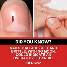 Overactive Thyroid, Unwanted Hair Growth, Graves Disease, The Dating Divas, Healthy Juice Recipes, Nail Bed, Brittle Nails, Healthy Liver, Natural Therapy