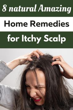 Remedies For Itchy Scalp, Remedy For Dandruff, Itchy Scalp Causes, Natural Dandruff Remedy, How To Treat Dandruff