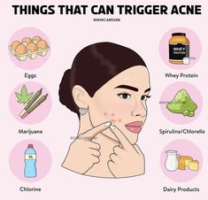 Face Mapping Acne, Beginner Skin Care Routine, Skin Advice, Basic Skin Care Routine, Clear Skin Tips, Face Acne, Facial Skin Care Routine, Skin Care Remedies, Body Skin Care Routine