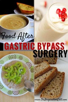 Bypass Surgery Diet, Gastric Bypass Diet