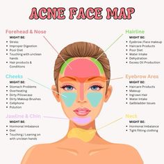 This "Acne Face Map" links acne in specific facial areas to potential causes. 

- Forehead & Nose: Stress, poor diet, digestion issues, hair products.
- Hairline: Makeup, haircare products, dehydration.
- Eyebrow Area: Haircare, makeup, ingrown hair.
- Cheeks: Stomach issues, dirty pillowcase, pollution.
- Jawline & Chin: Hormonal imbalance, diet.
- Neck: Hormonem imbalance, tight clothing.

#acneskincare #acnetreatment #clearskinjourney #acnetips #acnefree #blemishfree #acnefighter #acnecare #acnesolutions #fightacne #acnehelp #acneprone #acnecommunity #acnestruggles #acneskincareroutine #acnescars #acnesupport #breakoutfree #acnehealing #antiacne #adultacne #clearacne #acnecontrol #acnejourney #acnewarrior #acneprevention

Credit: @skin_selfish on Instagram Where Pimples Are Face Mapping, Pimple Face Guide, Stuff That Helps With Acne, What Spots Mean Face Mapping, Spot Mapping Face, What Pimples Mean Face Mapping, Spot Meanings On Face, Different Acne Areas, Acne Spot Meaning