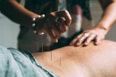 Acupunture Aesthetic, Accupuncture Aesthetic, Acupuncture Aesthetic, Body Massage Spa, Holistic Center, Acupuncture Clinic, Traditional Chinese Medicine Acupuncture