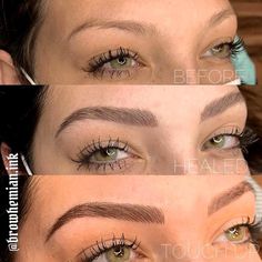 The combination brows healing process usually lasts 4-6 weeks and requires a certain aftercare routine. Let's find out what are the healing stages. Powder Combo Brows, Combination Eyebrow Tattoo, Powder Brows For Blondes, Combination Microblading Eyebrows, Micro Bladed Brows, Microshading Eyebrows Healing Process