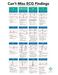 Medische Humor, Critical Care Nursing, Nursing School Studying, Nursing School Tips