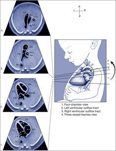 the diagram shows different stages of breathing