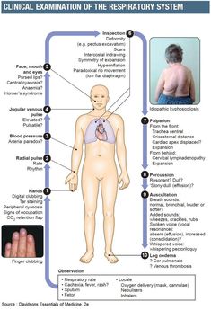 the diagram shows how to treat and treat for an expioratory system, as well as what you can expect