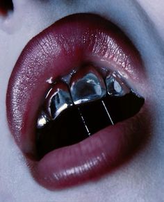 a woman's mouth with braces on it