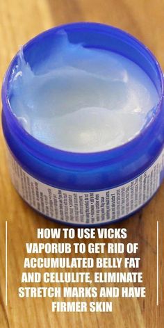 Using Vicks Vaporub For Chronic Headaches - If you have ever suffered from chronic stress, then you know how much Vicks Vaporub can help. Rub a little amount on your eyes and forehead as to relieve... Congested Nose, Headache Prevention, Inflammation Causes, Skin Tissue