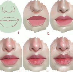 the stages of lip fillers