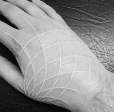 a person's hand with a bandaged wrist on top of a leather surface