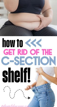 A mom after a c-section trying to lose her c-section shelf and another mom after she lost the postpartum belly pooch! Postpartum Wrap, C Section Recovery, Mommy Tummy, Belly Wrap