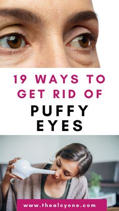 Got bags under your eye? Read this post to learn all the 19 cool natural ways to gegt rid of under eye bags. At least one could work for you. Click to learn more Watery Eyes, Under Eye Bags, Laser Therapy, Sagging Skin, Puffy Eyes, Facial Massage