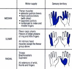 Upper Extremity Strengthening Occupational Therapy, Hand Therapy Occupational, Hand Nerves, Occupational Therapy Assistant, Medical Anatomy, Hand Therapy